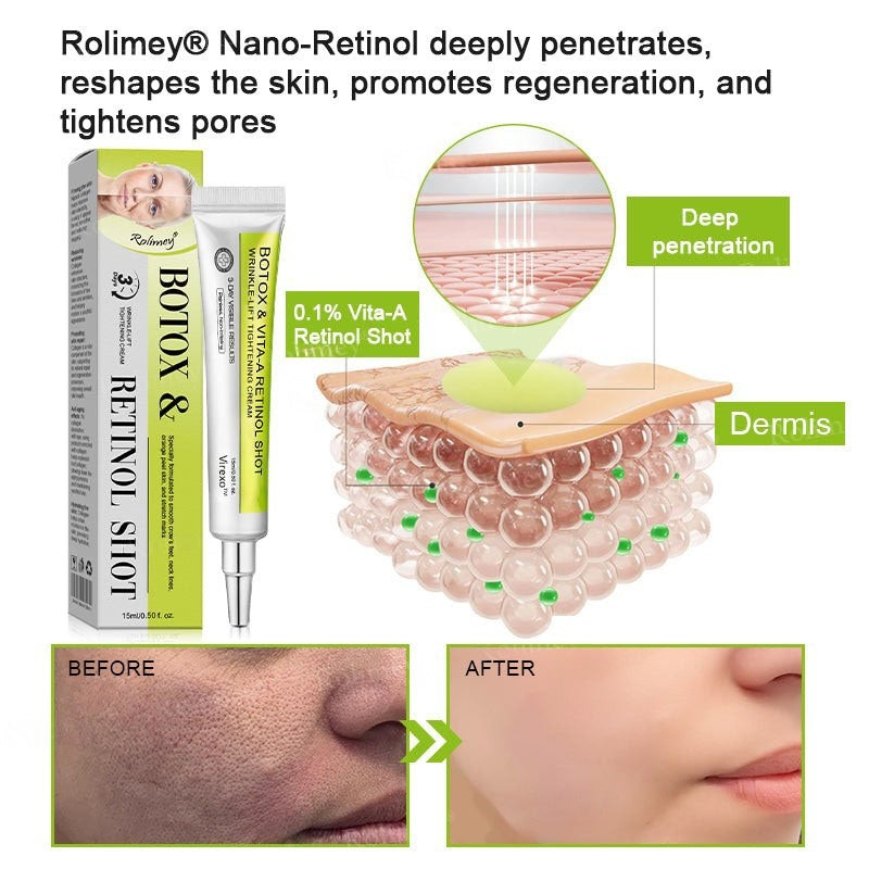 👨‍⚕️Made and shipped from Australia💫 Botox & Vita-A Retinol Shot Wrinkle-Lift Tightening cream - Last Day Promotion 70% OFF