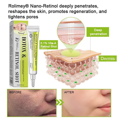 👨‍⚕️Made and shipped from Australia💫 Botox & Vita-A Retinol Shot Wrinkle-Lift Tightening cream - Last Day Promotion 70% OFF