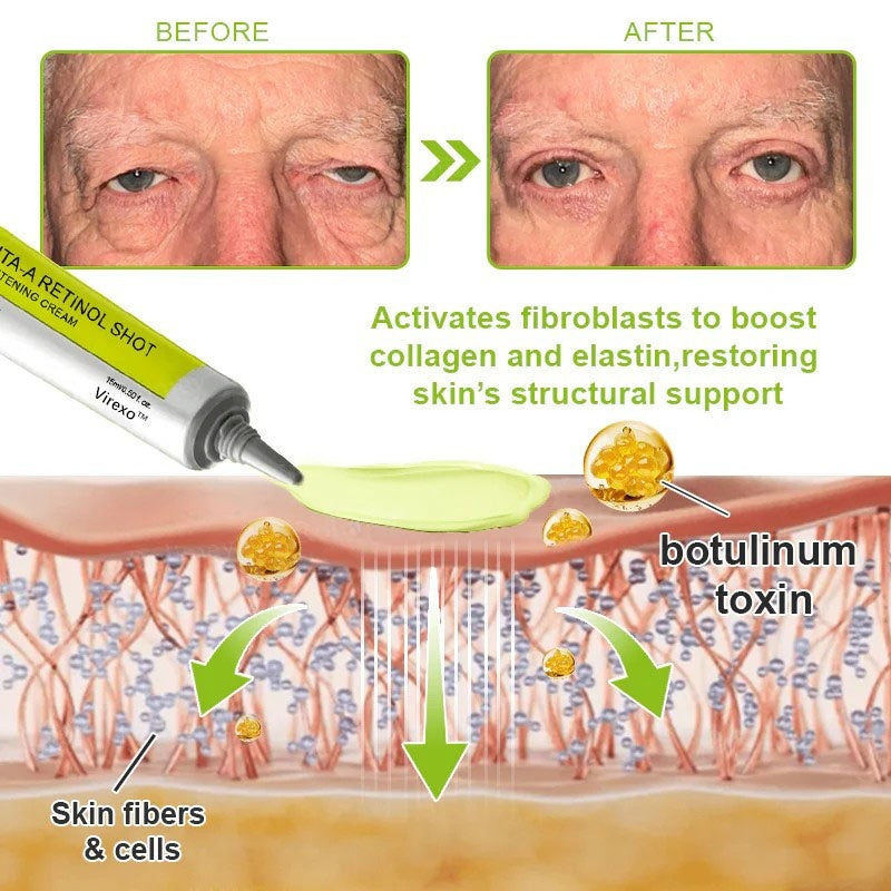 👨‍⚕️Made and shipped from Australia💫 Botox & Vita-A Retinol Shot Wrinkle-Lift Tightening cream - Last Day Promotion 70% OFF