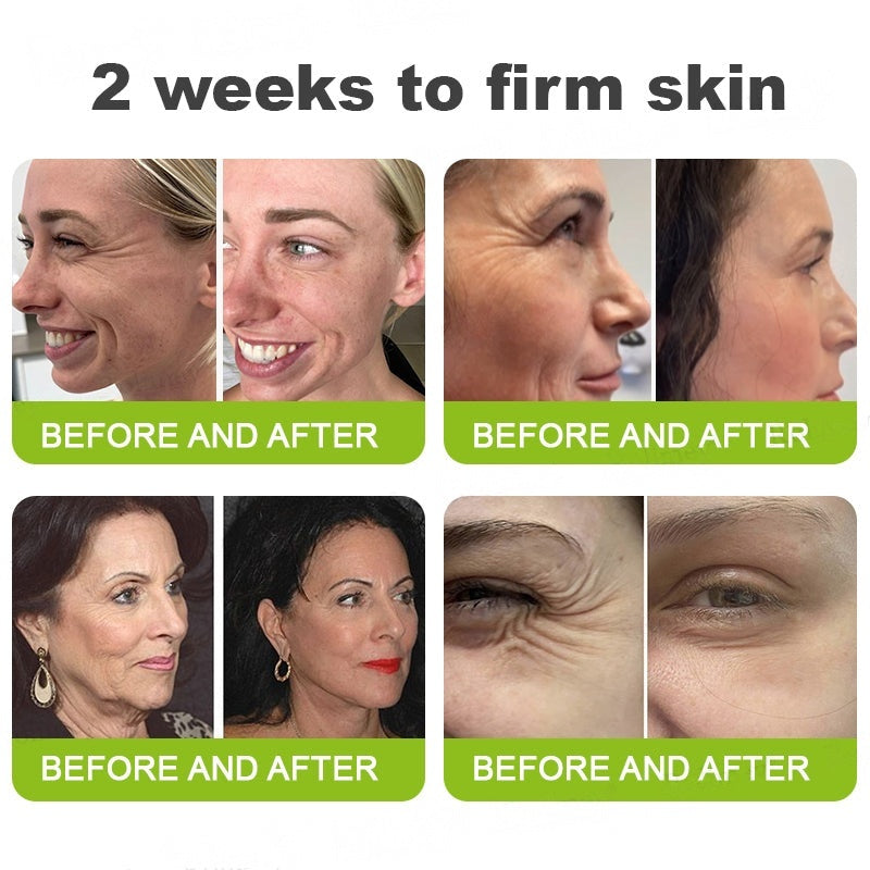 👨‍⚕️Made and shipped from Australia💫 Botox & Vita-A Retinol Shot Wrinkle-Lift Tightening cream - Last Day Promotion 70% OFF