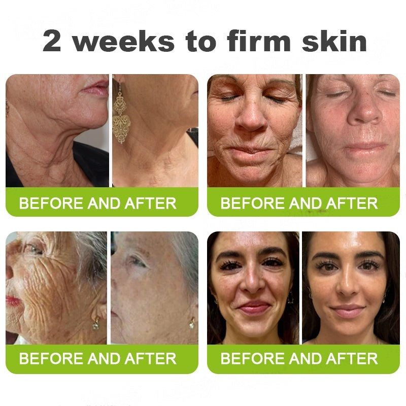 👨‍⚕️Made and shipped from Australia💫 Botox & Vita-A Retinol Shot Wrinkle-Lift Tightening cream - Last Day Promotion 70% OFF