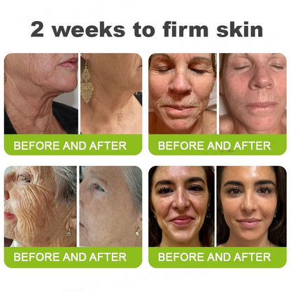 👨‍⚕️Made and shipped from Australia💫 Botox & Vita-A Retinol Shot Wrinkle-Lift Tightening cream - Last Day Promotion 70% OFF
